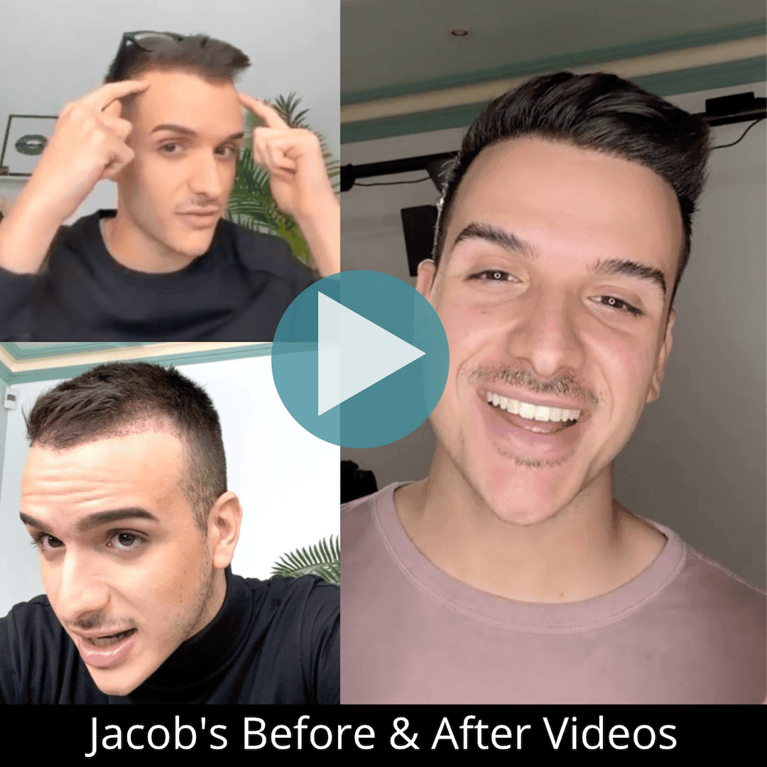 Jacob B&A Video Image-min